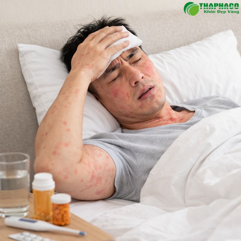 Các Bệnh Lý Thường Gặp Liên Quan Đến Cứng Khớp