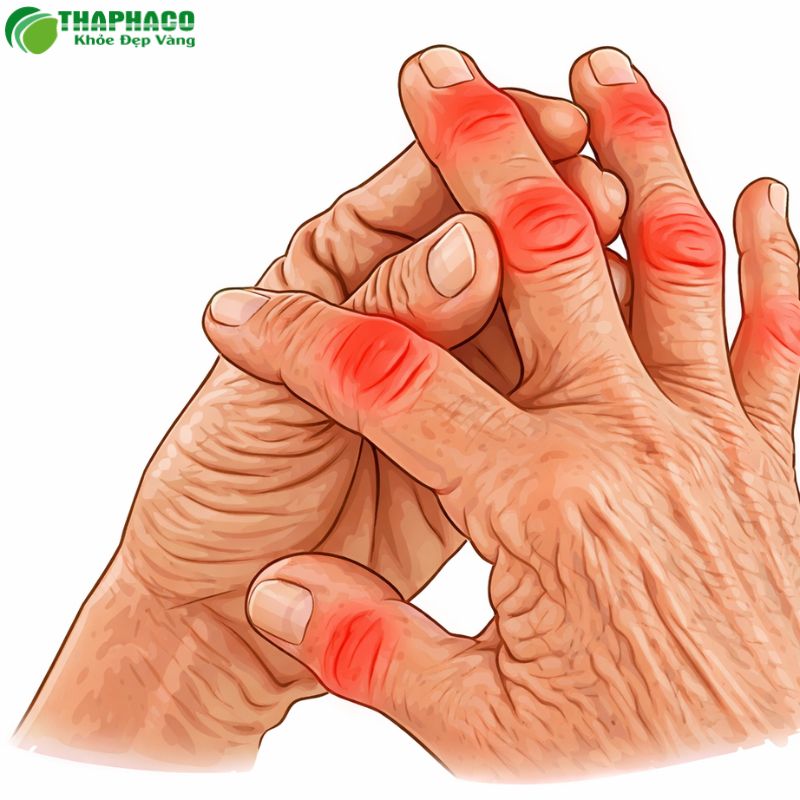 đau nhức xương khớp là gì