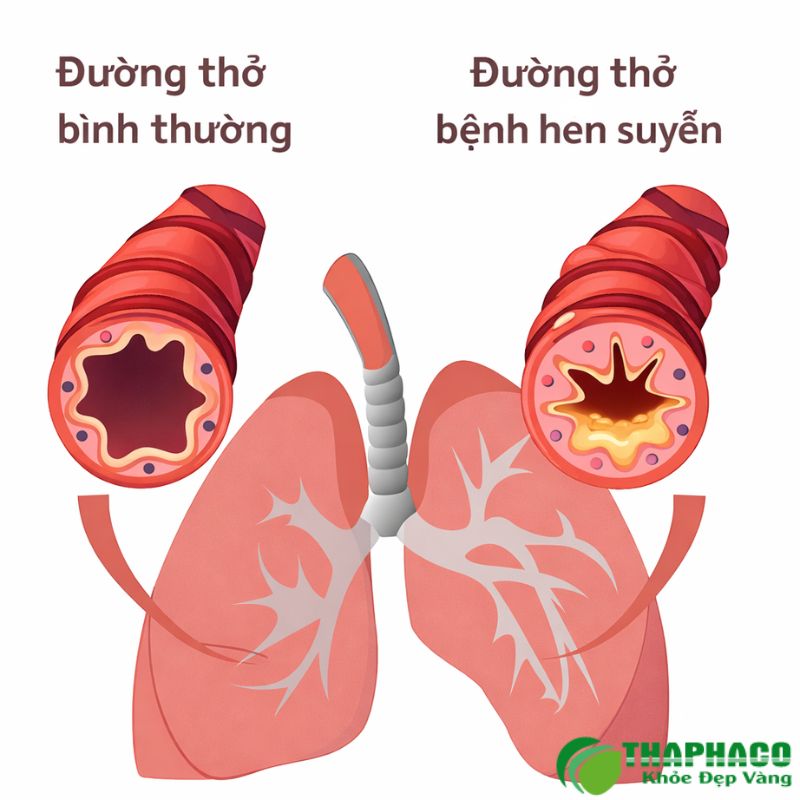 Dược liệu hỗ trợ làm loãng và tống xuất đờm, giúp thông thoáng đường thở