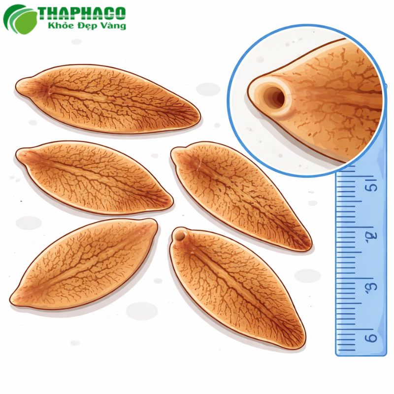 Nhiễm sán lá gan là một bệnh ký sinh trùng mãn tính do các loài sán lá gan gây ra