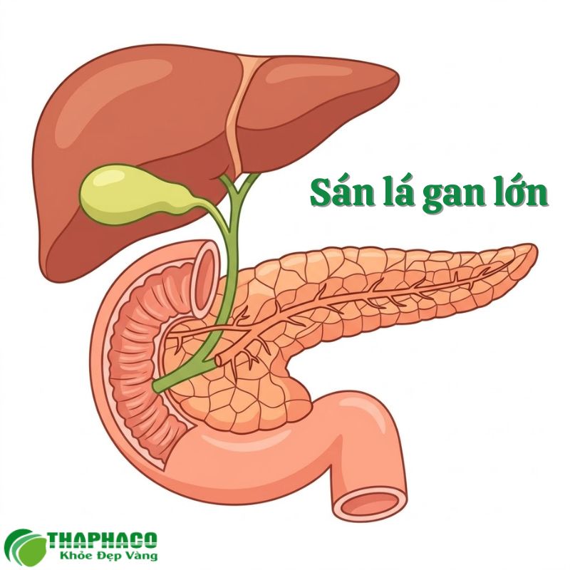 sán lá gan lớn là gì
