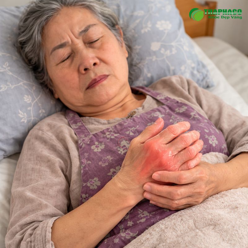 Sưng, nóng, đỏ ở khớp: Dấu hiệu của tình trạng viêm