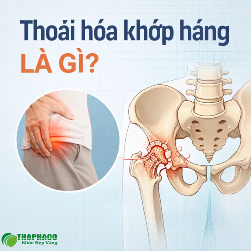 Thoái hoá khớp háng là gì