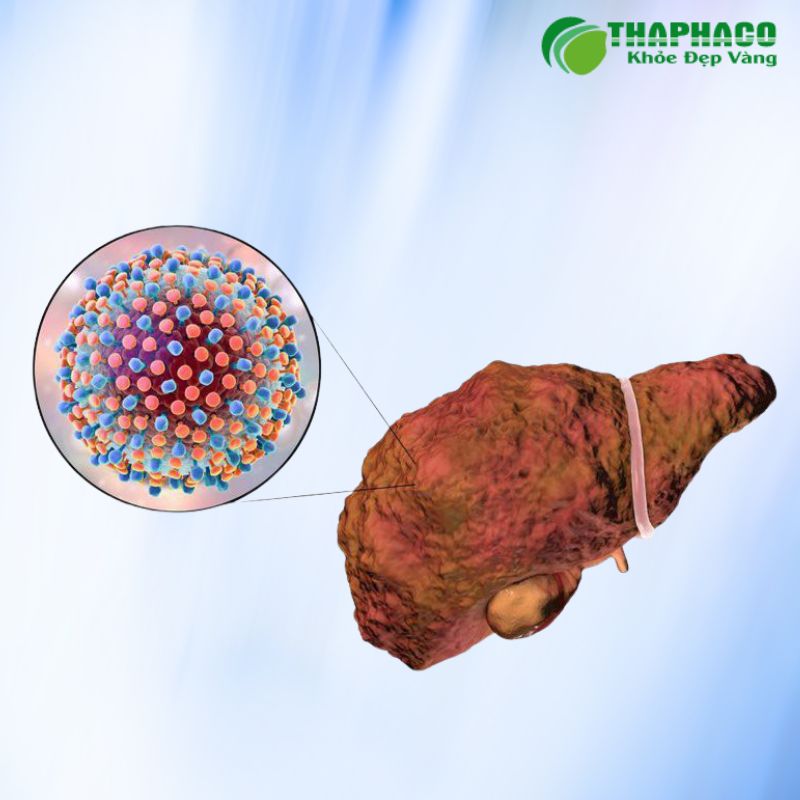 ứ mật trong gan là gì