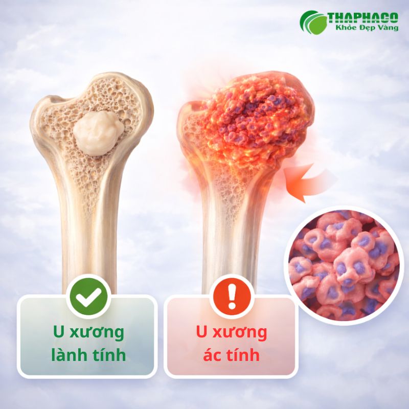 u xương là gì