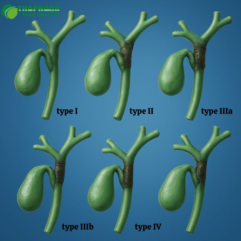 ung thư đường mật là gì