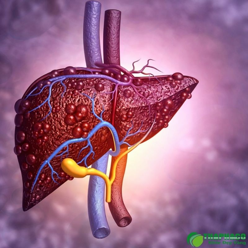 viêm gan cấp là gì