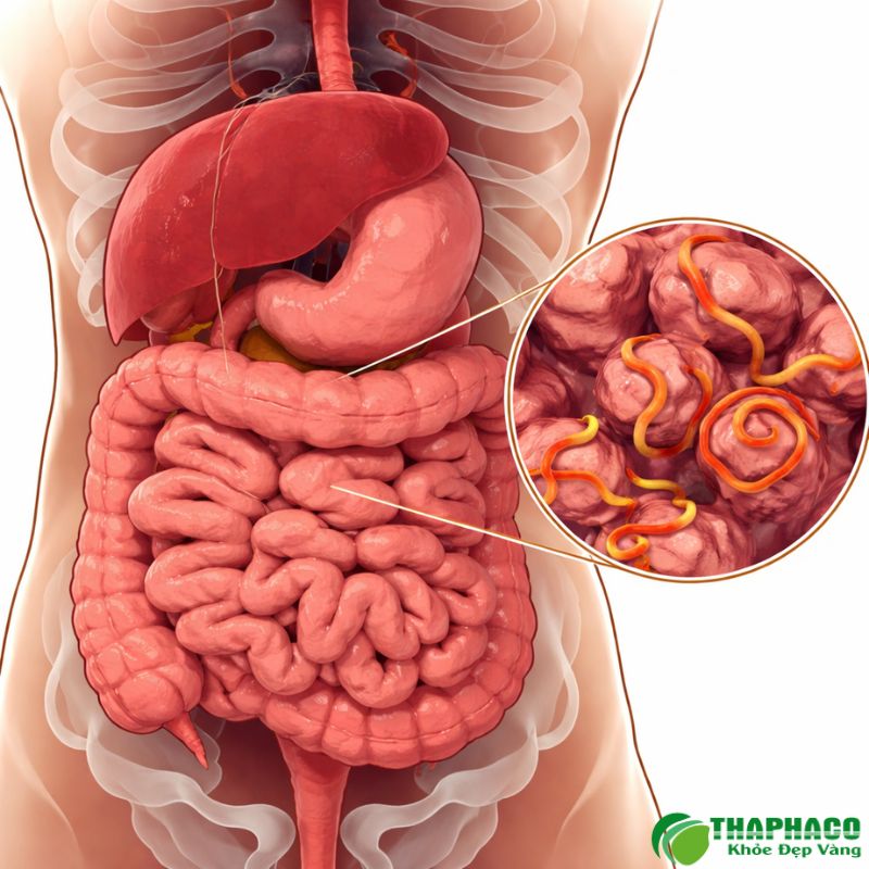 Chẩn Đoán Và Phương Pháp Điều Trị Viêm Gan Do Ký Sinh Trùng