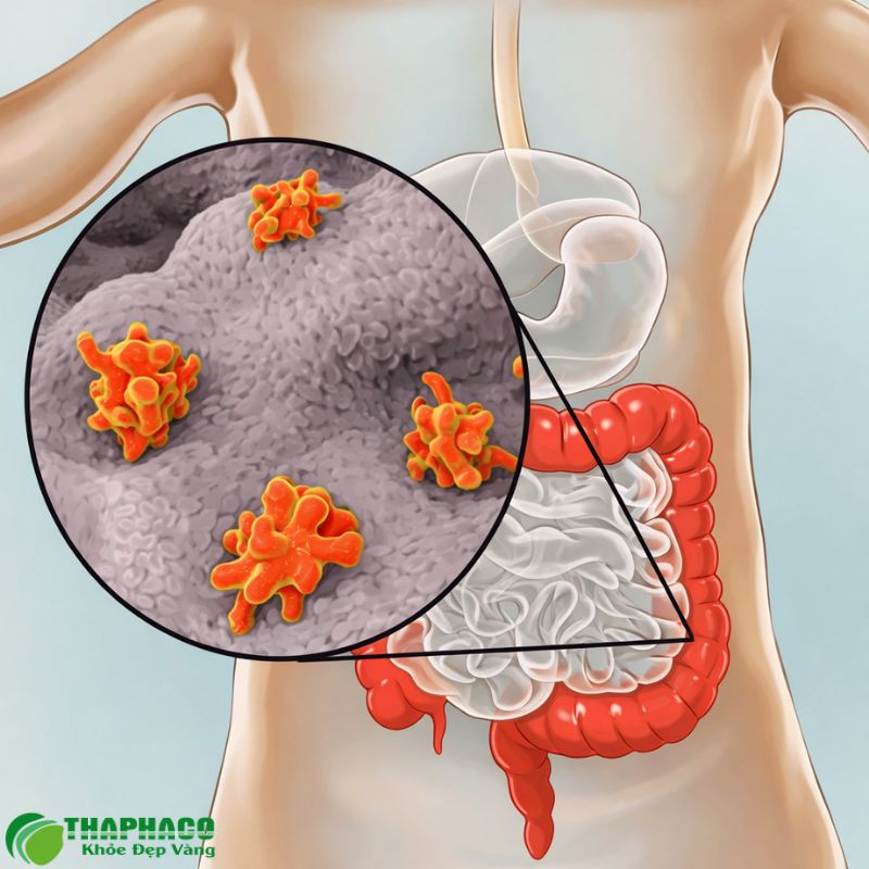 Viêm gan do ký sinh trùng là một bệnh lý cần được điều trị y tế chuyên sâu
