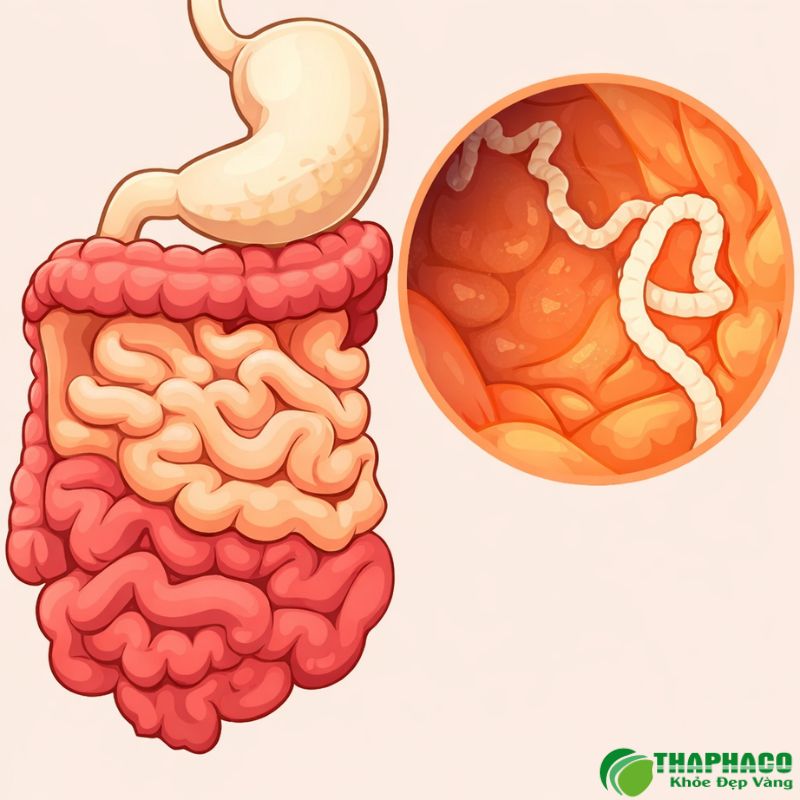 viêm gan do ký sinh trùng là gì