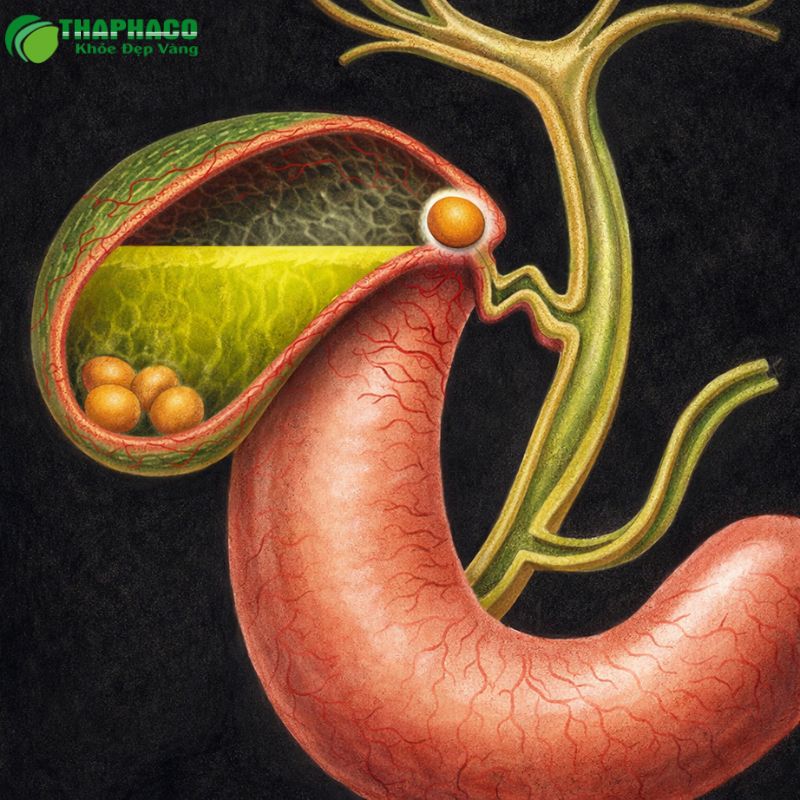 Các Phương Pháp Điều Trị Viêm Túi Mật Hiệu Quả Hiện Nay