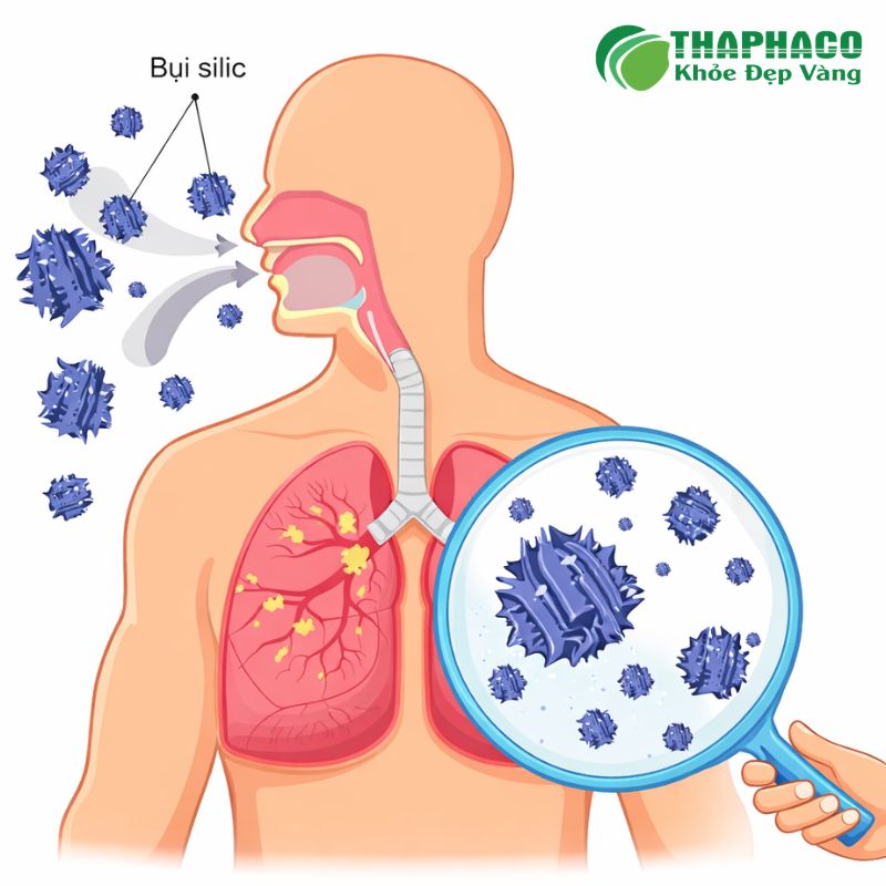 Dược liệu tự nhiên từ Thaphaco có thể hỗ trợ làm sạch phổi, giảm viêm