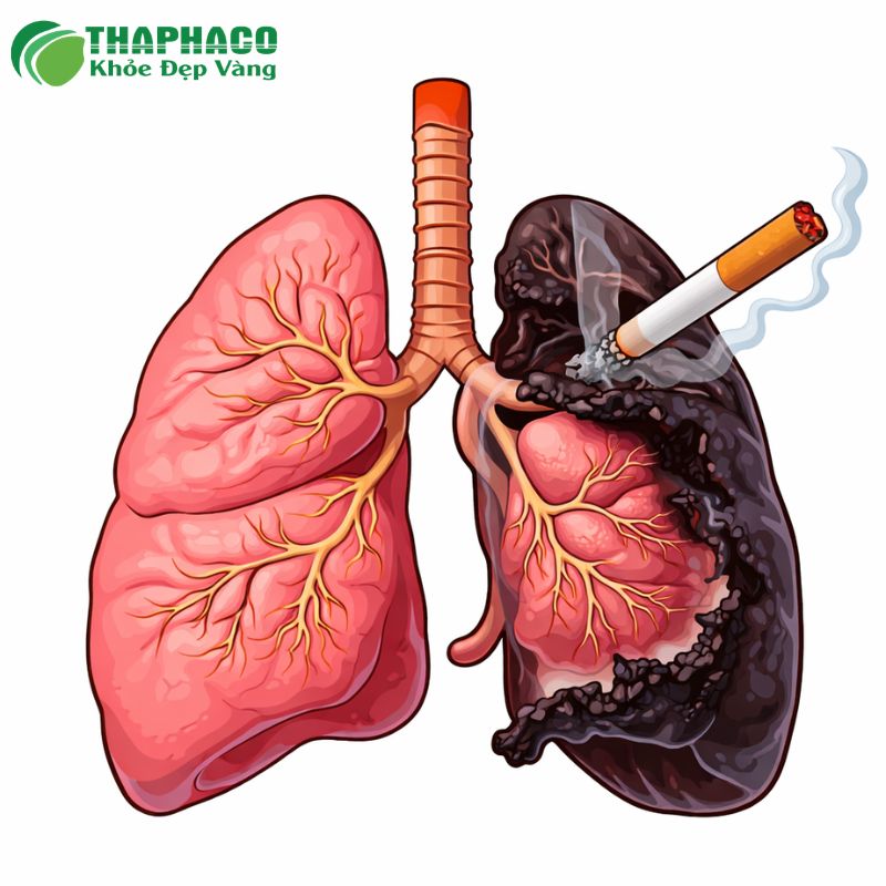 bệnh phổi do thuốc lá là gì