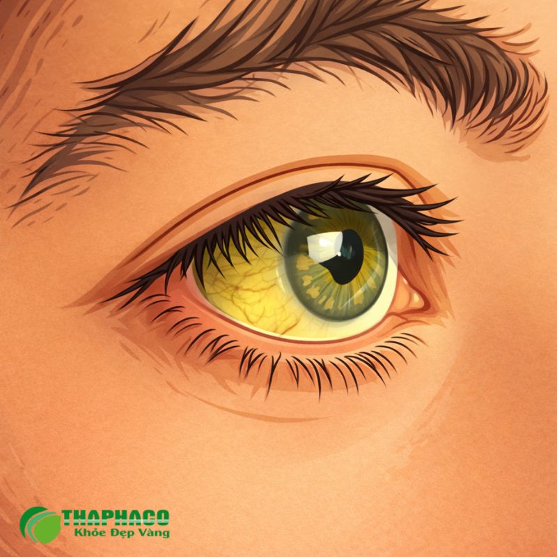 Lưu Ý Quan Trọng Khi Sống Chung Với Hội Chứng Gilbert