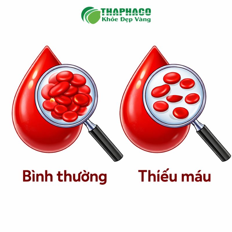 thiếu máu do mất máu là bệnh gì