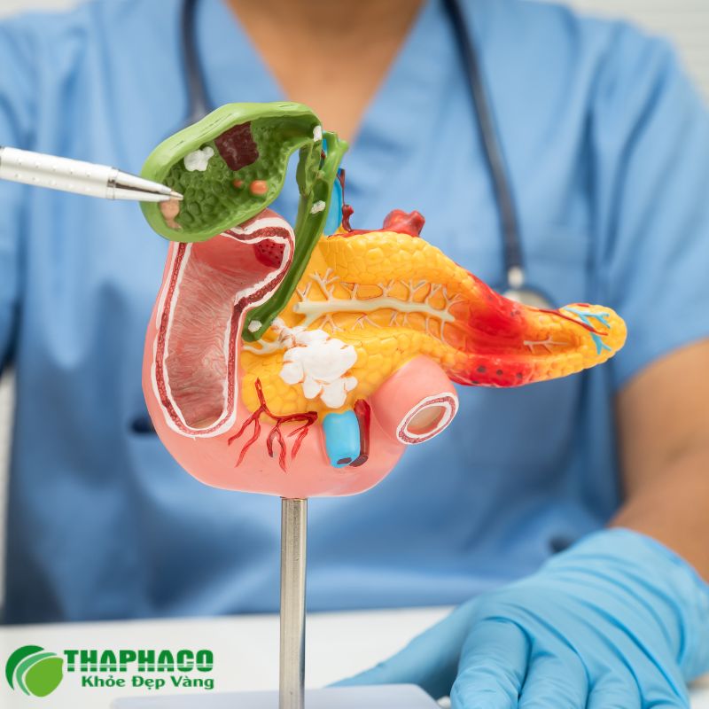 túi mật co rút là gì