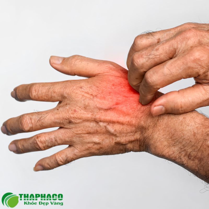 Ngứa Da Dữ Dội Là Một Trong Những Dấu Hiệu Ung Thư Túi Mật