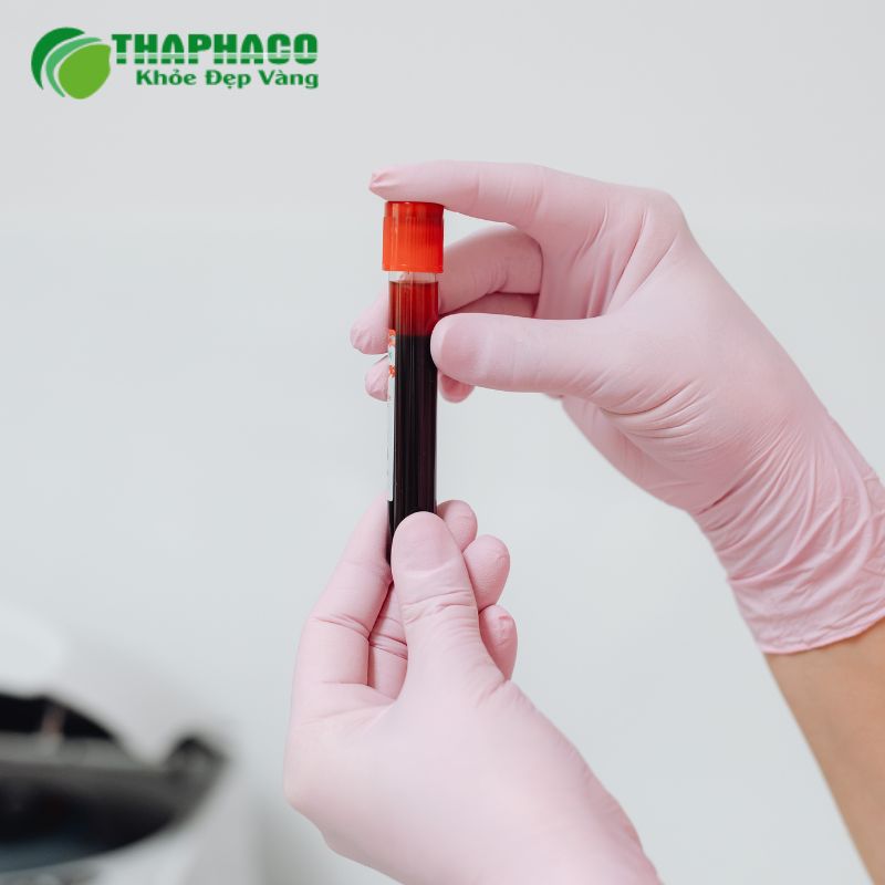 Đo nồng độ creatinine và BUN (ure máu) để đánh giá chức năng thận