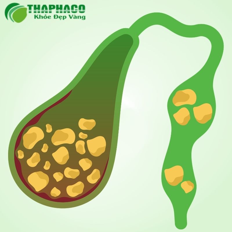 Thaphaco cung cấp các giải pháp hỗ trợ đường mật từ dược liệu tự nhiên 