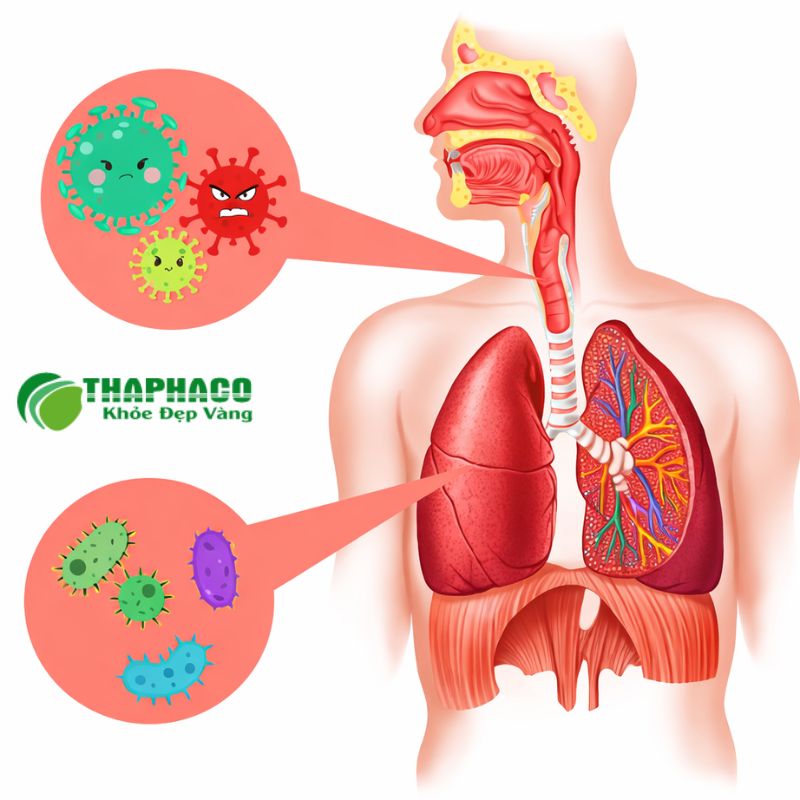 Triệu chứng nhận biết viêm phế quản cấp và biến chứng nguy hiểm