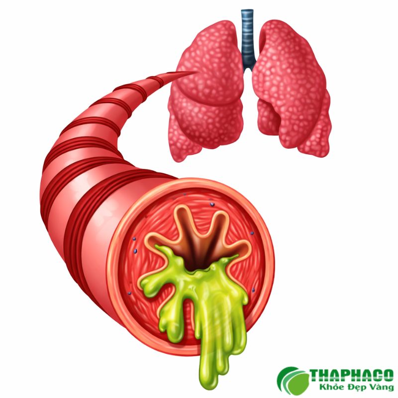 Lá Hen là dược liệu truyền thống giúp giãn phế quản, làm loãng đờm và giảm ho