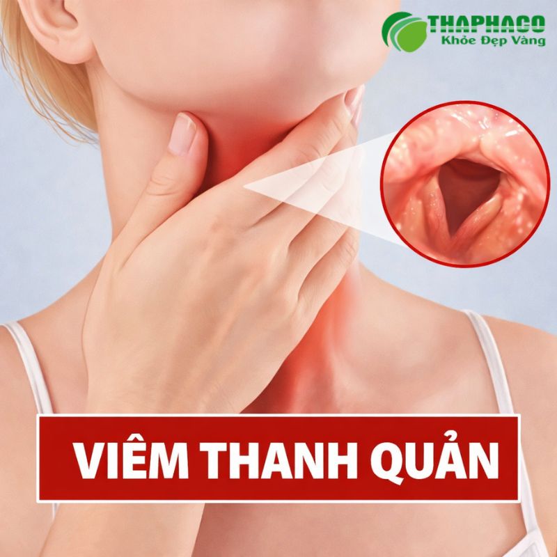 viêm thanh quản là gì