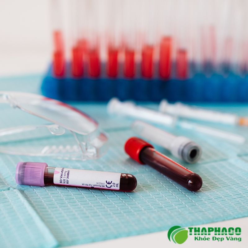Chẩn đoán Hashimoto dựa trên xét nghiệm máu kiểm tra TSH, hormone tuyến giáp