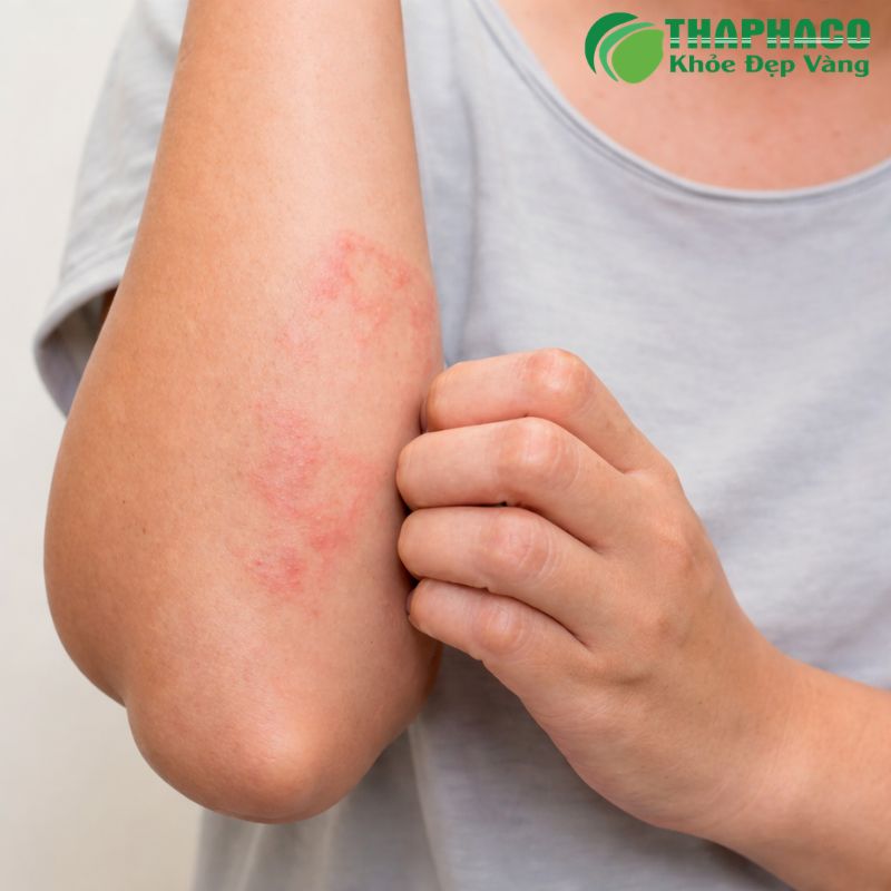 Tiếp xúc với dị nguyên lông động vật có thể gây ra các phản ứng da như viêm da dị ứng, mề đay