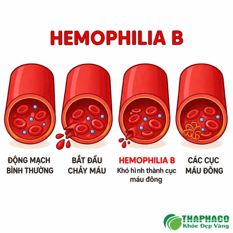 hemophilia b là bệnh gì