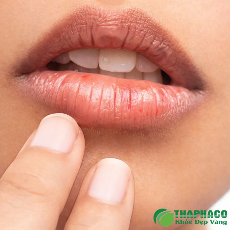 Nguyên nhân và yếu tố nguy cơ của Hội chứng Sjogren