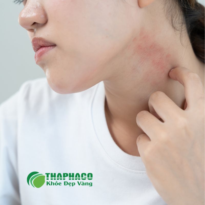 ngứa da do rối loạn miễn dịch là gì
