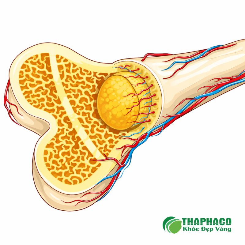 rối loạn tăng sinh tuỷ là bệnh gì