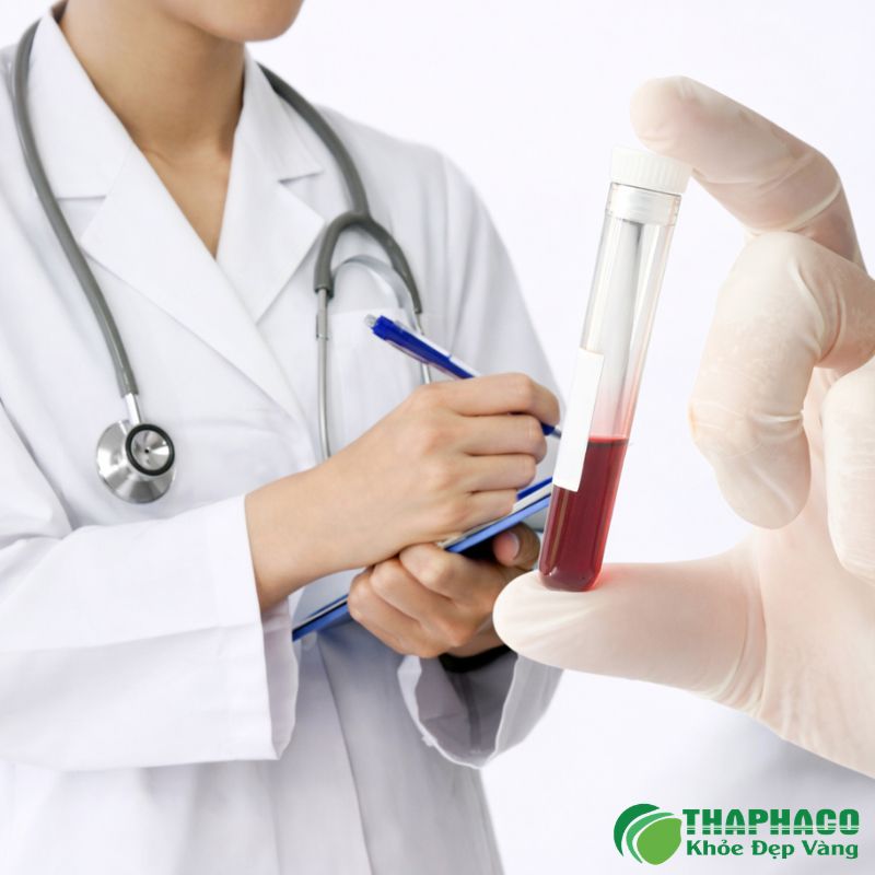 Chẩn đoán MPN đòi hỏi các xét nghiệm chuyên sâu như xét nghiệm máu