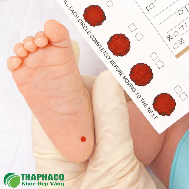 Thiếu men G6PD do di truyền, nhưng các cơn tan máu cấp tính mới là biểu hiện rõ rệt, gây ra vàng da