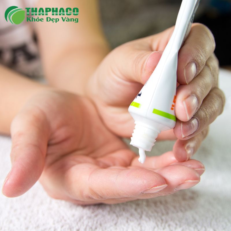 Các phương pháp điều trị và kiểm soát Vảy Nến hiệu quả