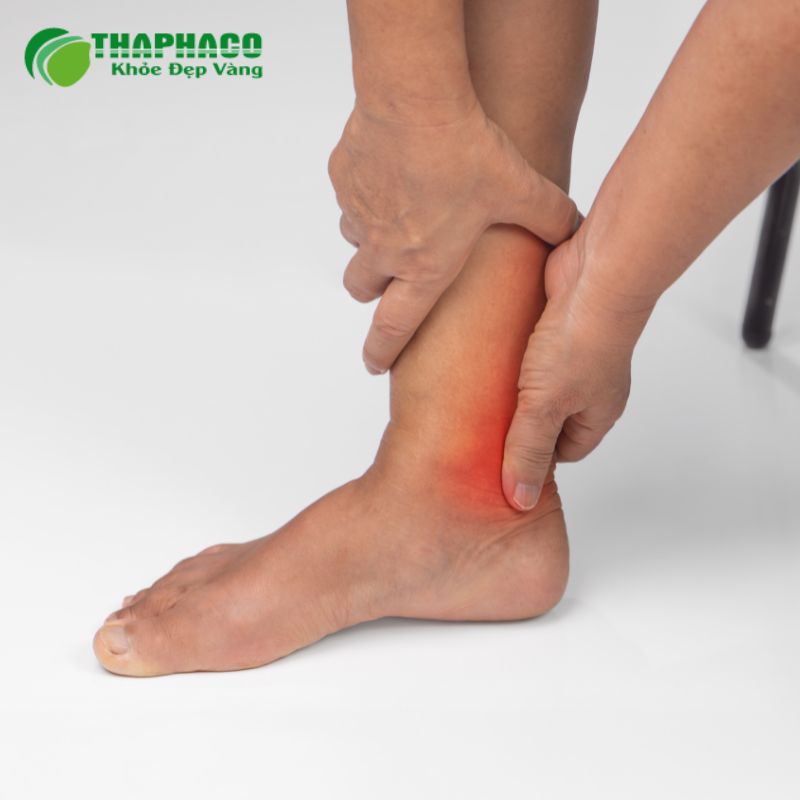 Nhận biết sớm Gout thông qua các triệu chứng cấp tính như đau đột ngột, sưng, nóng, đỏ ở khớp