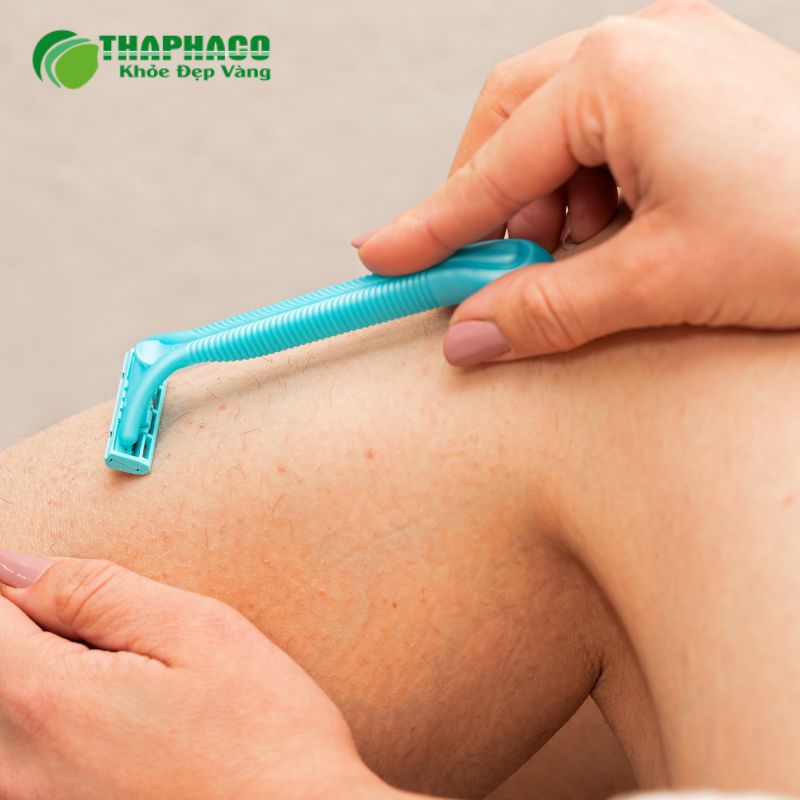 Giải pháp điều trị và quản lý Bệnh rậm lông hiệu quả