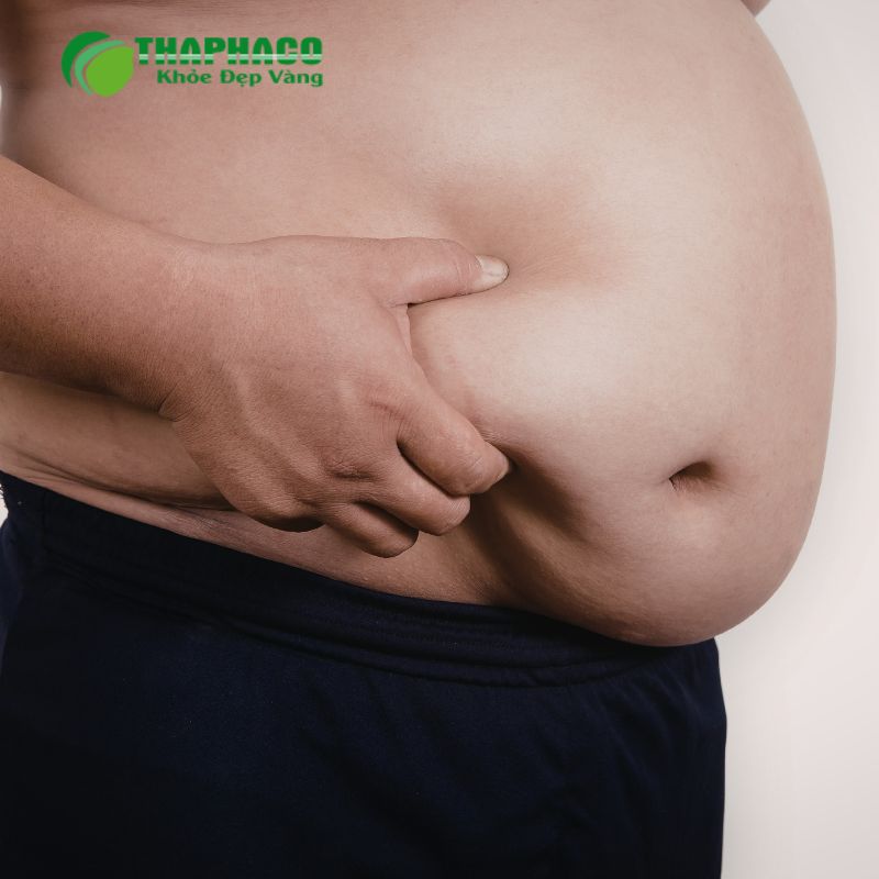 Béo phì là sự tích tụ mỡ thừa quá mức trong cơ thể, gây ảnh hưởng tiêu cực đến sức khỏe