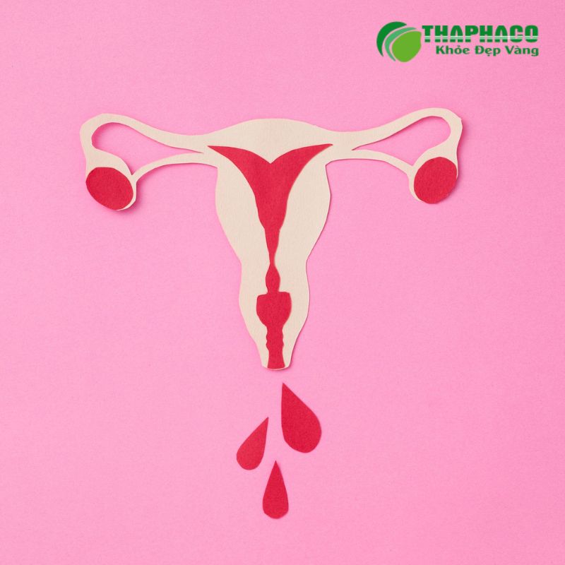 Tình trạng rong kinh, mất máu nhiều do kinh nguyệt không đều có thể dẫn đến thiếu máu