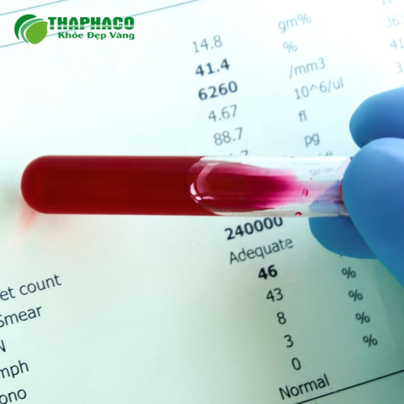 Ngay cả khi không có triệu chứng, việc kiểm tra lipid máu thường xuyên cực kỳ quan trọng