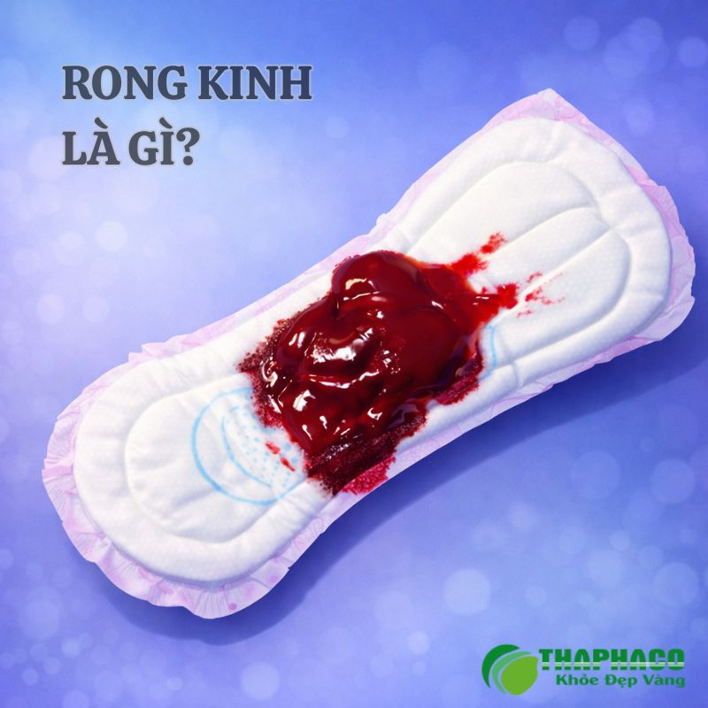 rong kinh là gì