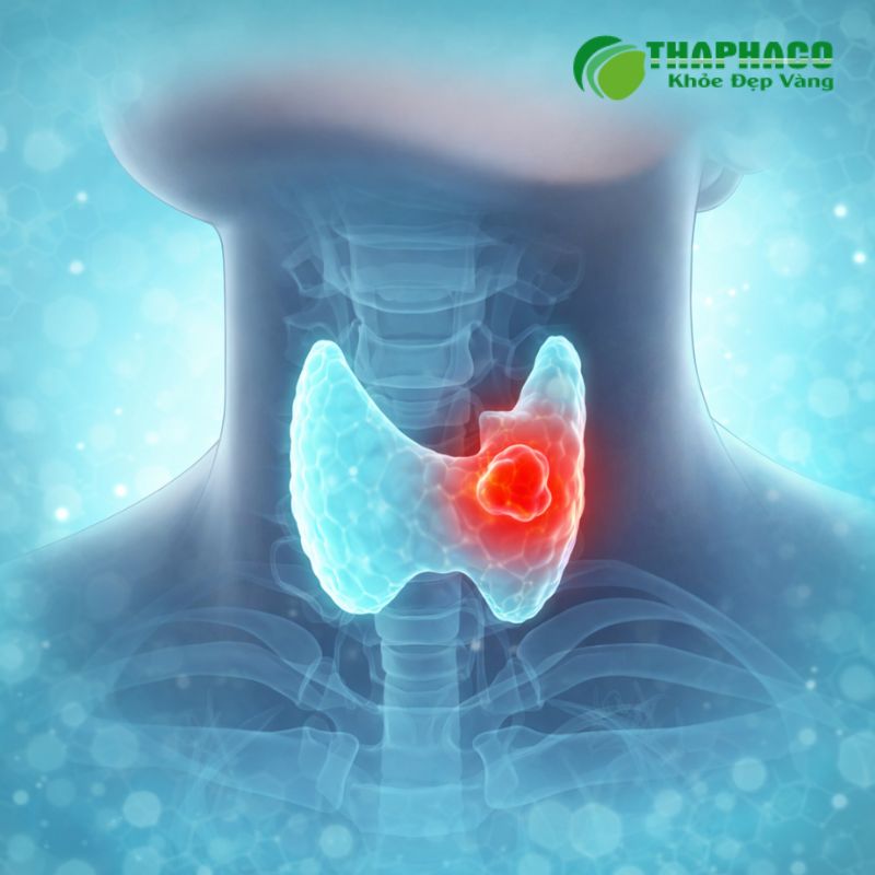 Suy tuyến cận giáp là tình trạng thiếu hụt hormone PTH
