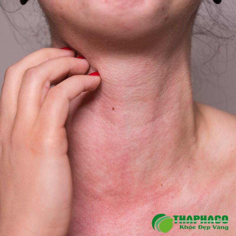 Lưu Ý Quan Trọng Khi Dùng Dược Liệu Hỗ Trợ Sức Khoẻ 