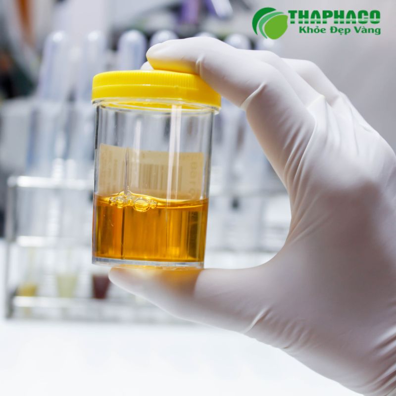 Các Phương Pháp Điều Trị Và Hỗ Trợ Giảm Tiểu Rắt Hiệu Quả