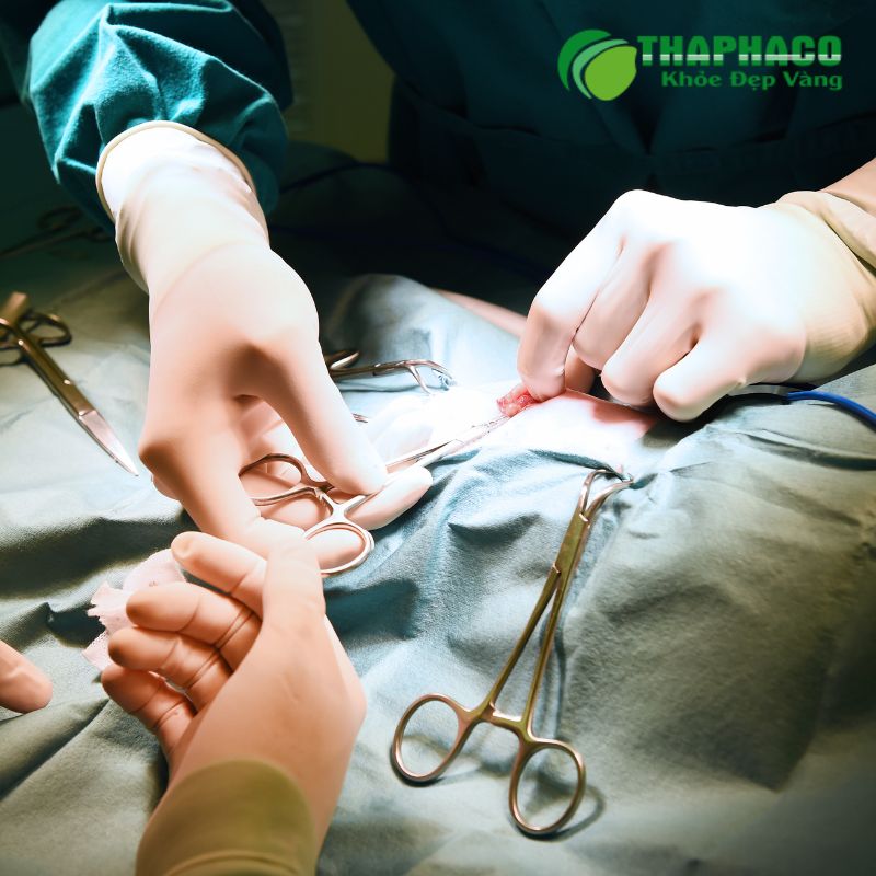 Phương pháp chẩn đoán và điều trị u nang buồng trứng hiệu quả