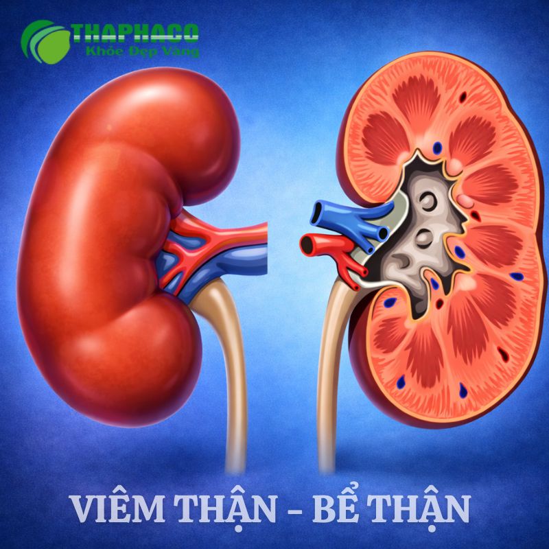 viêm thận bể thận là gì
