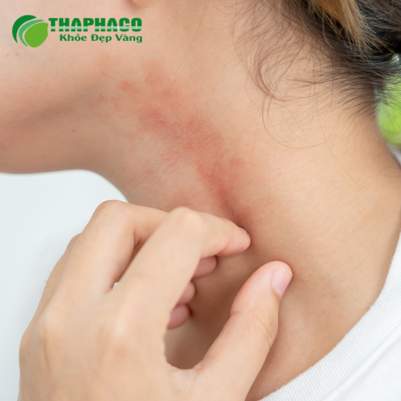 Triệu Chứng Nhận Biết Viêm Thận Kẽ Cấp Tính và Mạn Tính