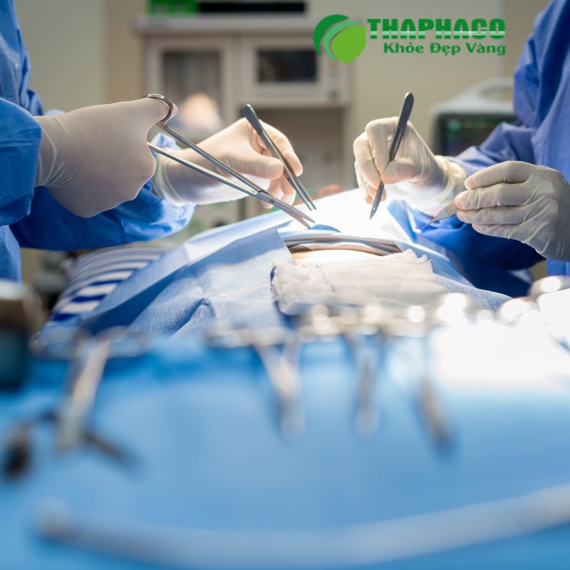 Điều trị áp xe hậu môn chủ yếu là phẫu thuật rạch dẫn lưu mủ để loại bỏ ổ nhiễm trùng