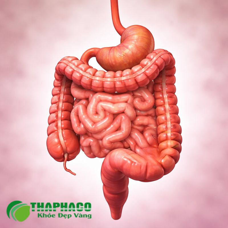 Bệnh Crohn là một tình trạng viêm mạn tính ảnh hưởng đến đường tiêu hóa