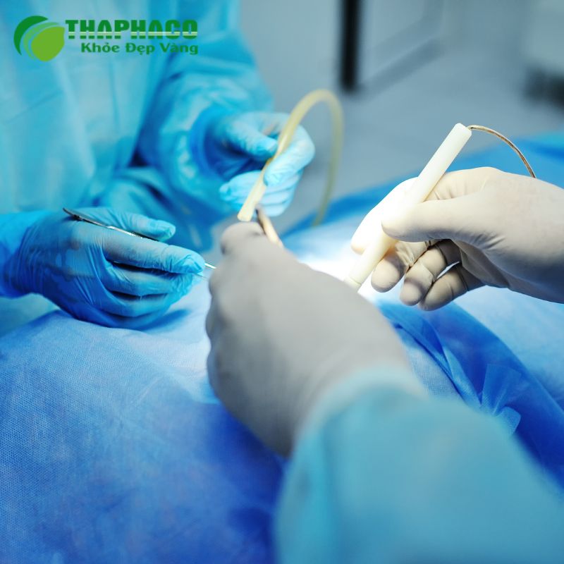 Phương Pháp Điều Trị và Quản Lý Bệnh Tim Bẩm Sinh